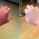 Illustration for article titled How Do You Function, When One Hand Is Out of Commission?